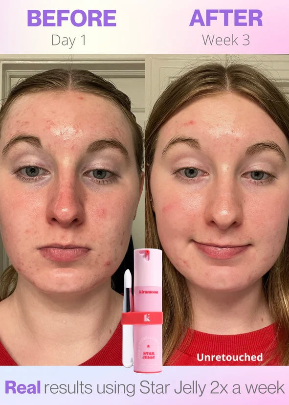 Kiramoon Star Jelly Instant Radiance Exfoliating Mask